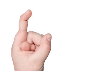 Finger of a child's hand is bent in the upper (first) phalanx of the finger. Hyperviscosity bones,...