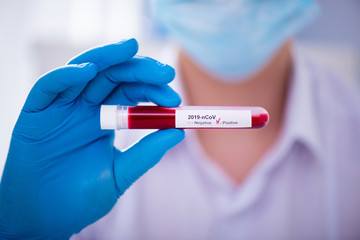 Test tube in male hand close up, doctor in medical mask holding vial with red liquid. Concept blood...