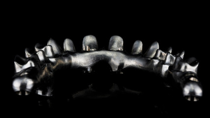 high-quality titanium beam for the manufacture of an upper jaw prosthesis, view from the inside of the prosthesis © Dental Pro Content