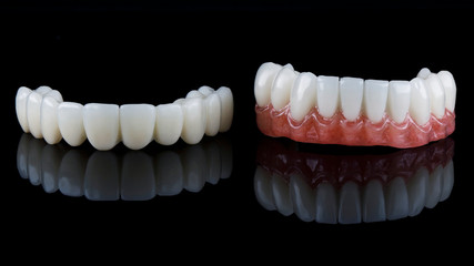 two precise temporary dental prostheses for the entire jaw of the patient, the prostheses are made...