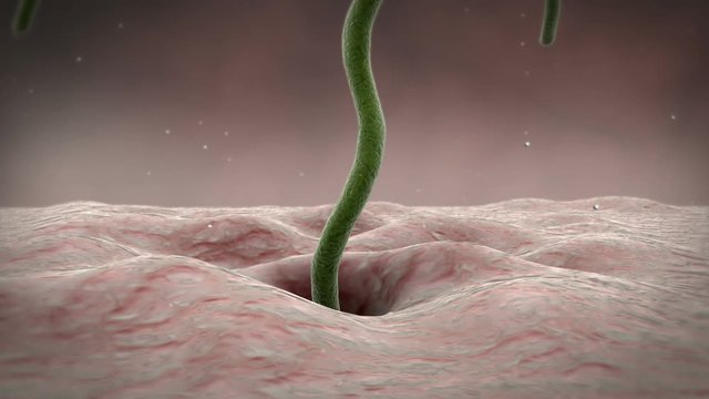 Biomedical animation showing Helicobacter pylori bacteria entering stomach wall.