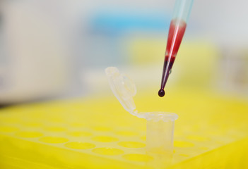 a drop of blood close-up at the end of a medical pipette or dispenser in the laboratory. Blood test