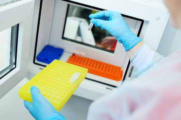 the doctor's hand in a rubber glove holds a blood sample in a test tube against the background of the window of the chemical and bacteriological laboratory. The disease, a coronavirus infection.