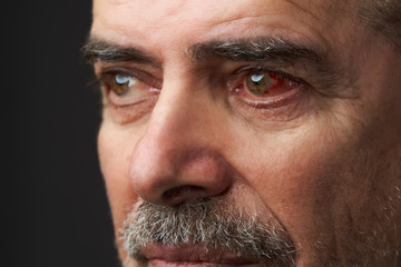 Obraz premium Close-up annoyed red blood eye of senior man