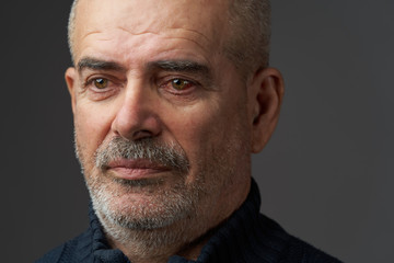 Close-up annoyed red blood eye of senior man