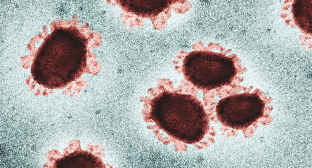 Covid-19, Sars-Cov-2, Coronavirus realistisch unter dem Mikroskop - obrazy, fototapety, plakaty