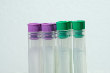 purple and green blood collection tubes in the middle White background