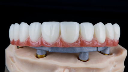 Macro photo of the upper jaw on a special dental beam and a model made in a 3D printer © Dental Pro Content