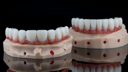 Dental prosthesis of the upper jaw in the foreground, shot on a black background with reflection