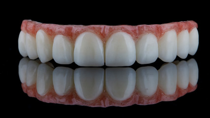 temporary dental prosthesis made of special plastic on a black background with reflection