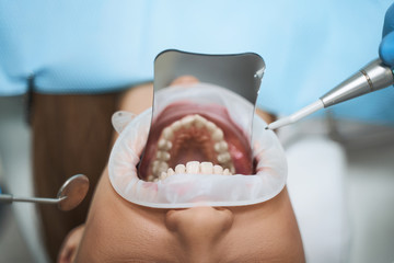 Young woman during dental treatment stock photo