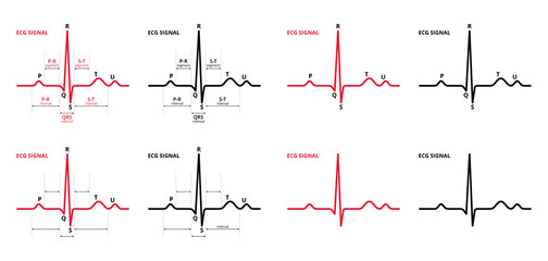 Sets of Electrocardiogram ECG or EKG heart beat graph signal pulse color and black on white background