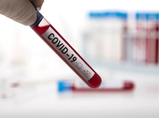 Obraz premium Microbiologist with a tube of biological sample contaminated by Coronavirus with label Covid-19