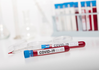 Fototapeta premium Tubes of biological sample contaminated by Coronavirus with label Covid-19