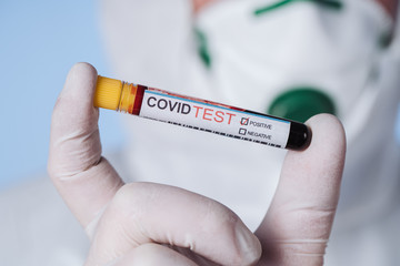 Microbiologist with a tube of biological sample contaminated by Coronavirus with label Covid Test....