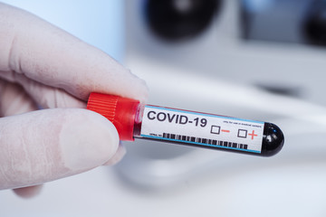 Blood test tube for 2019 nCoV analysis. Coronavirus COVID-19 vaccine glass bottle in the...