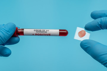 Doctor holds COVID 19 Coronavirus vaccine in his hand, infected blood sample in the sample tube, Vaccine and syringe injection It use for prevention, immunization and treatment from COVID-19