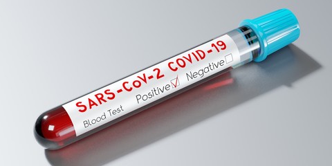 Obraz premium Coronavirus, SARS-CoV-2, Covid-19 virus - test tube, blood test - 3D illustration