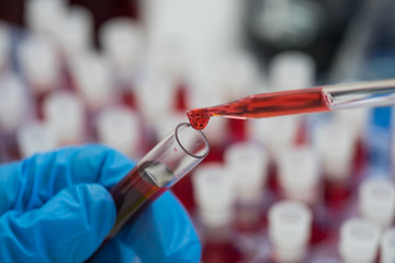 Scientist hand holding test tube with blood in laboratory.