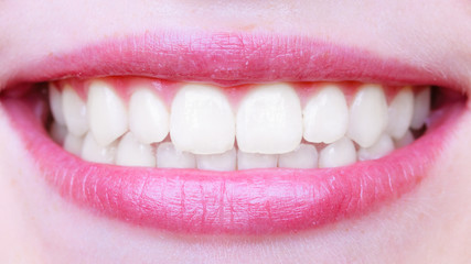 Young woman with healthy teeth