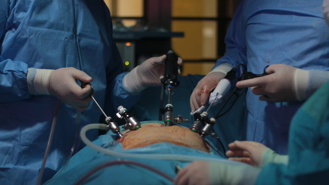 laparoscopic surgery 