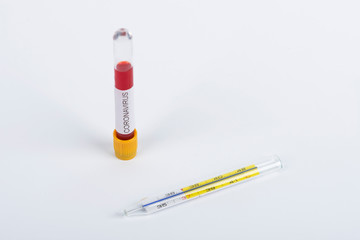 Coronavirus blood test concept. Test tube with Coronavirus positive blood on laboratory desk. Positive blood test result.
