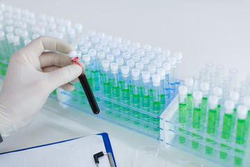 Close up photo of a doctor's hands with a test tube with a blood sample. A lot of test tubes on background.