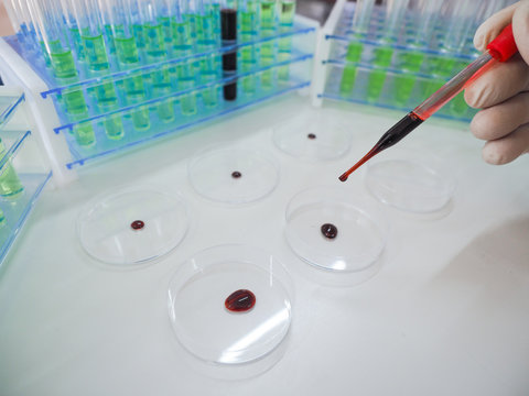 Close up view of a pipette in a researcher's hands dripping a blood sampe in a Petri sish.