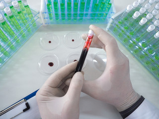 Photo of diseased blood sample in a researcher's hands. Vaccine creation. View from a researcher's eyes.