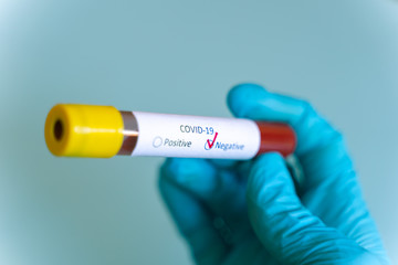 Fototapeta premium Hand in blue glove holding Test vial with Sample blood test of Coronavirus (Covid-19), Coronavirus Covid 19 infected blood sample. Negative result