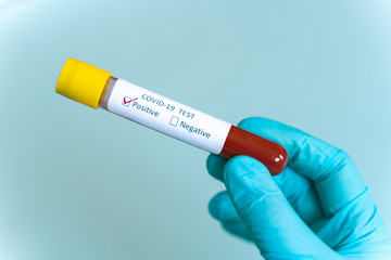 Obraz premium Hand in blue glove holding Test vial with Sample blood test of Coronavirus (Covid-19), Coronavirus Covid 19 infected blood sample. Positive result