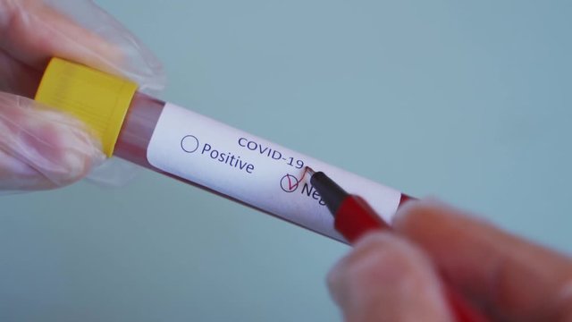 Hand checking the box Negative result on Test vial with Sample blood test of Coronavirus (Covid-19), Coronavirus Covid 19 infected blood sample. 