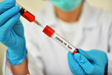 Lab technician holding blood sample tube for COVID-19 test