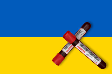 Test tubes with the Inscription 2019-nCoV on the background of the Ukraine Flag. 3D Rendering