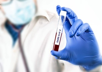 Corona. Coronavirus test. Doctor, laboratory practitioner holding a test tube with a blood sample.