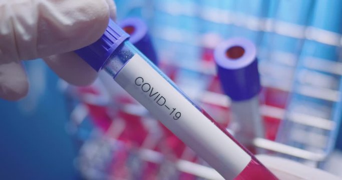 Laboratory test tube labeled COVID-19 in scientist hands with blue background. POV close-up shot.