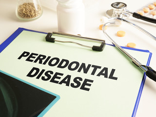Conceptual hand written text showing Periodontal disease