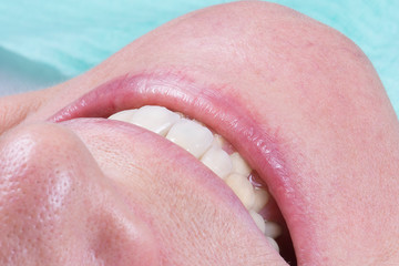 Obraz premium face and teeth