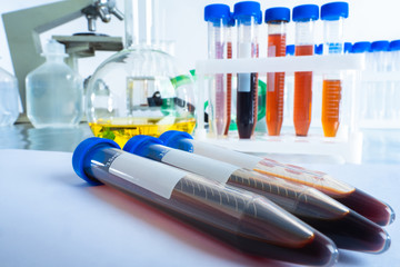 Test tubes with blood close up. Concept - the study of blood tests. Plastic tubes with blood on a...