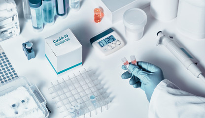 Novel coronavirus 2019 nCoV RT-PCR diagnostics kit. It contains reagents, primers and control...