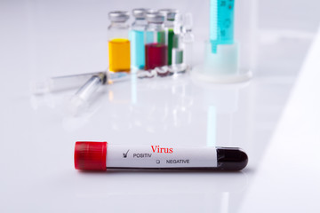 Blood test tube with virus positive result. Blood sample with COVID-19. White reflective surface.