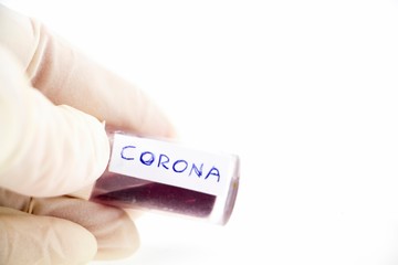 Corona blood test