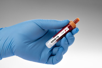 covid-19 - test sample tube with coronavirus in lab