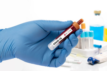 covid-19 - test sample tube with coronavirus in lab