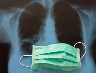 Lungs on X-ray film and medical mask, health care roentgen background, pneumonia prevention concept