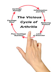 Steps in Vicious Cycle of Arthritis