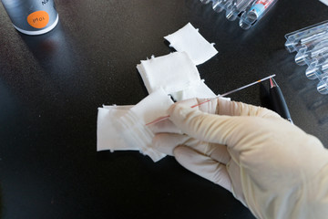 Lactat Test Blood 