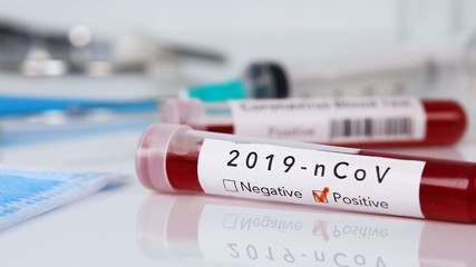 Test-tube with positive results to CORONAVIRUS COVID-19 check