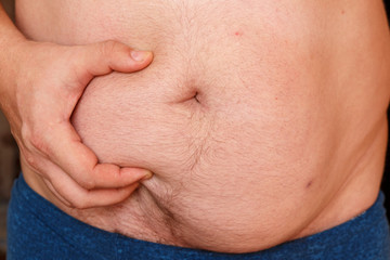 A man holds his stomach with his hand and shows his fat.