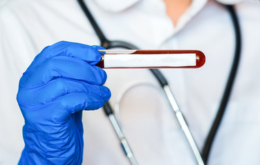 
doctor holds  test tube with blood test